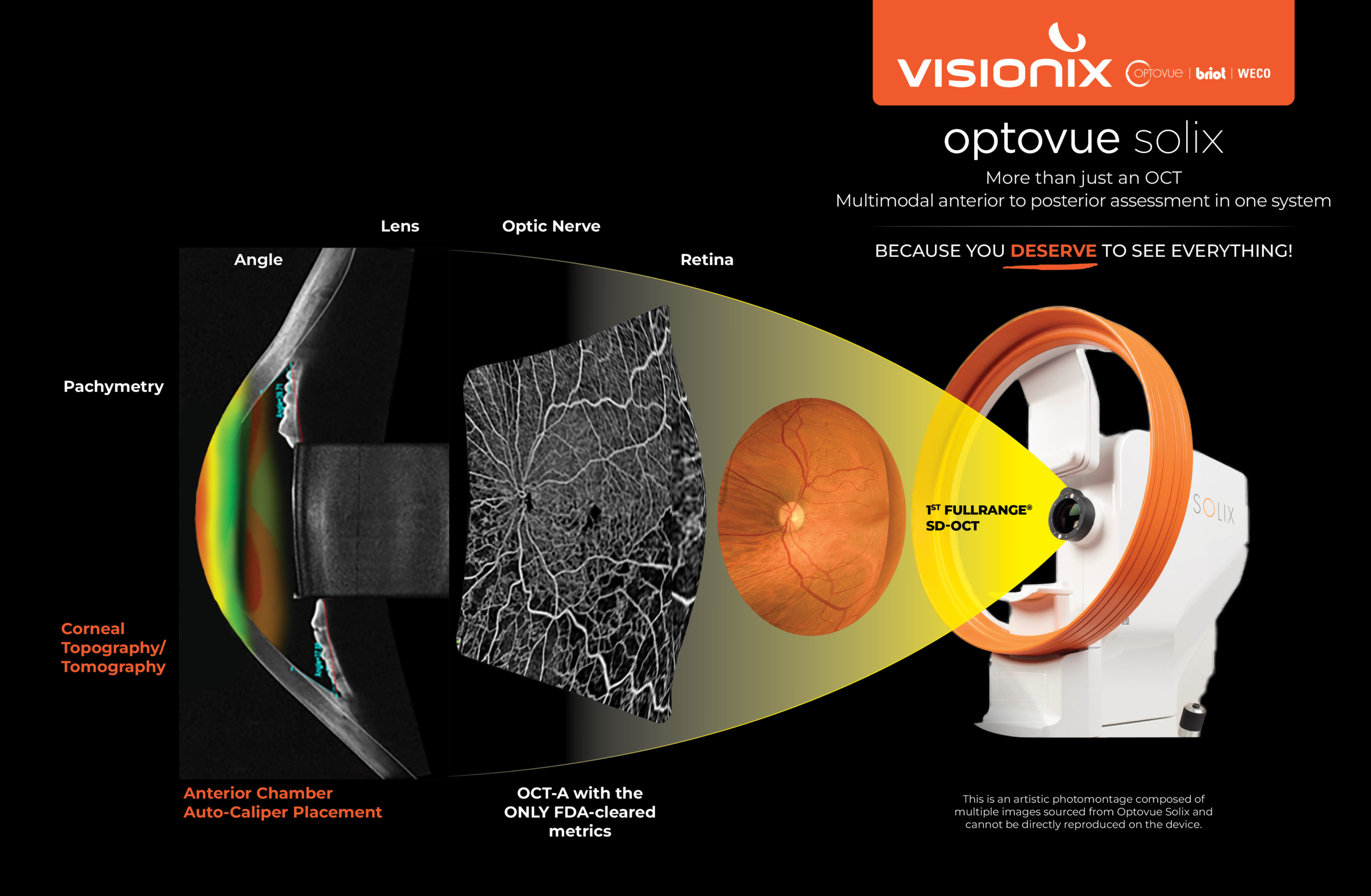 Diagram showing an eye exam using the Optovue Solix OCT device, with labeled eye anatomy, imaging processes, and the device on the right.