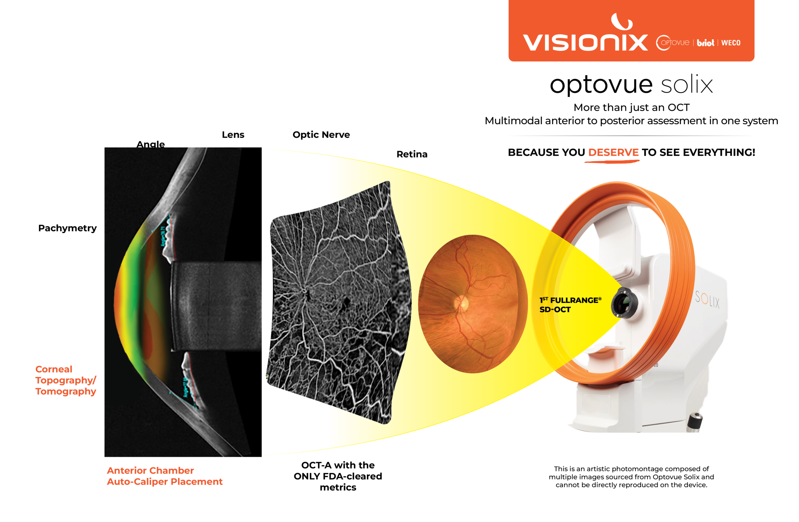Image transparent Optovue Solix Anterior to Posterior in one device graphic Diagram showing an eye exam process: anterior chamber topography, optic nerve imaging, and retina imaging, using the Visionix Optovue Solix SD-OCT device.